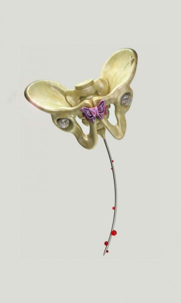110Butterfly Pin (Initial Identification)_1998-2007_mixed media, sculpted and cast in polymeric materials_h.50 cm